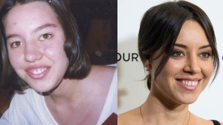 Actress Aubrey Plaza is believed to have undergone plastic surgery.